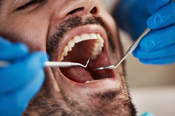 Best Same-Day Emergency Dental Services in East Porterville, CA
