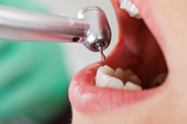 Best Weekend Emergency Dentist in East Porterville, CA